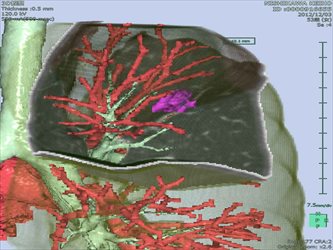 画像解析ソフトで確認できる動脈