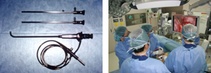 video-assisted-thoracic-surgery