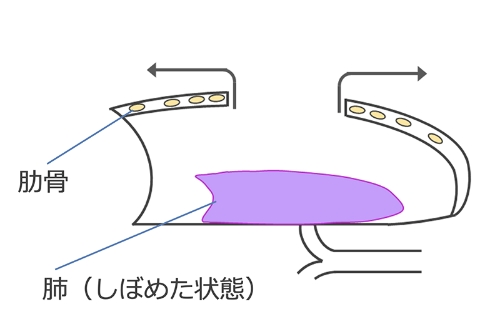 開胸手術