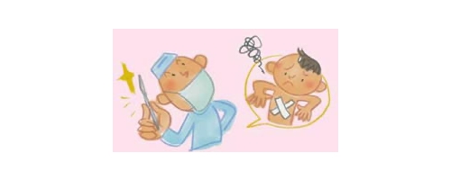 漏斗胸の手術